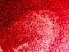 Fibrina en gota de sangre coagulada al microscopio Fibrina en gota de sangre coagulada al microscopio